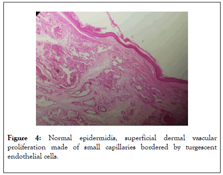 clinical-experimental-dermatology-epidermidis