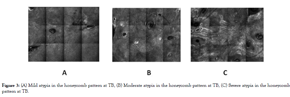 clinical-experimental-dermatology-honeycomb-pattern