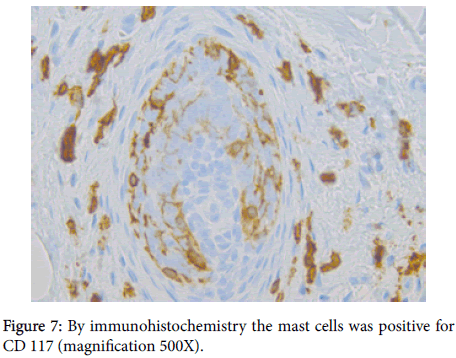 clinical-experimental-dermatology-immunohistochemistry