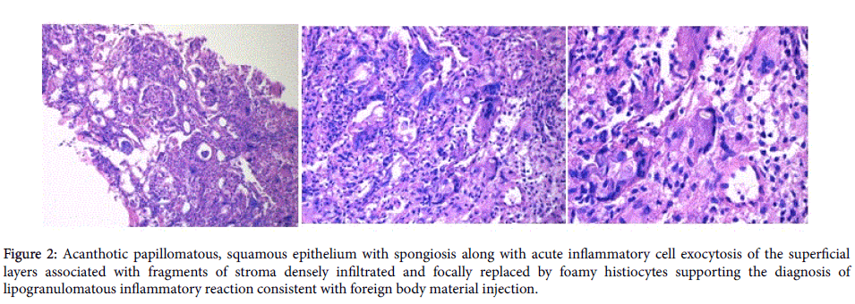 clinical-experimental-dermatology-inflammatory-reaction