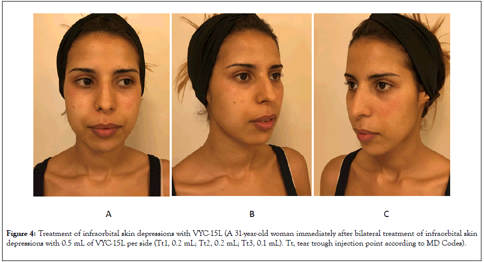 clinical-experimental-dermatology-infraorbital