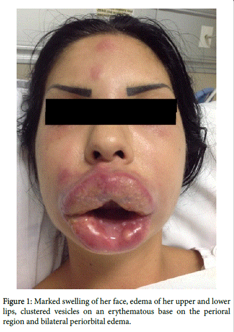 clinical-experimental-dermatology-lower-lips