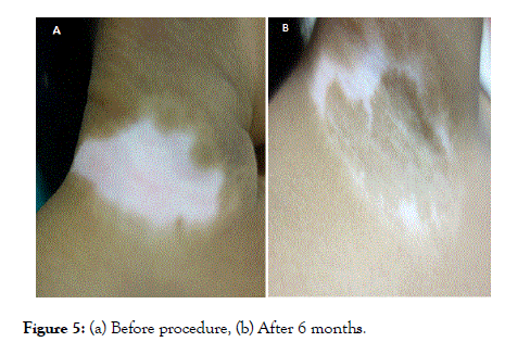 clinical-experimental-dermatology-months