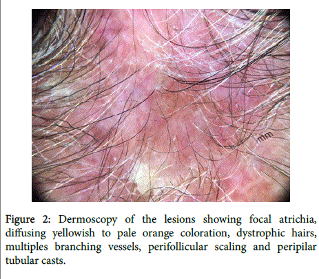 clinical-experimental-dermatology-orange-coloration