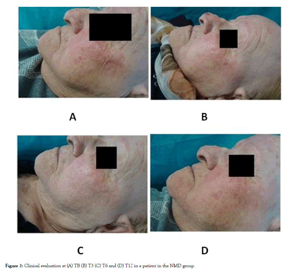 clinical-experimental-dermatology-patient