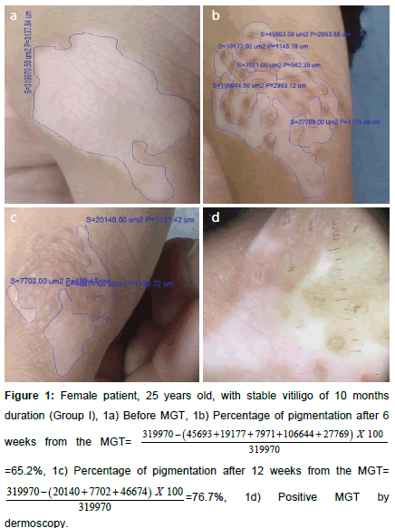 clinical-experimental-dermatology-pigmentation