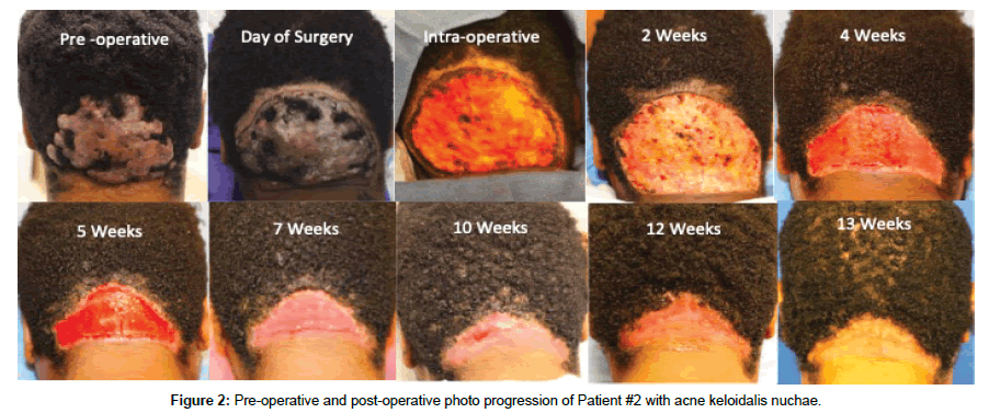 clinical-experimental-dermatology-post-operative