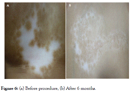 clinical-experimental-dermatology-procedure