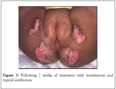 clinical-experimental-dermatology-research-antibiotics