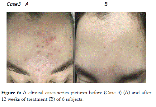 clinical-experimental-dermatology-research-cases-series