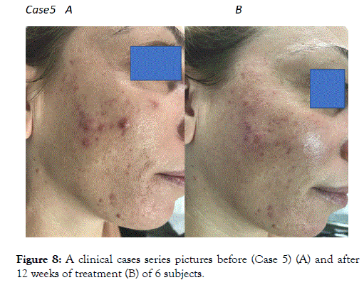 clinical-experimental-dermatology-research-clinical-cases