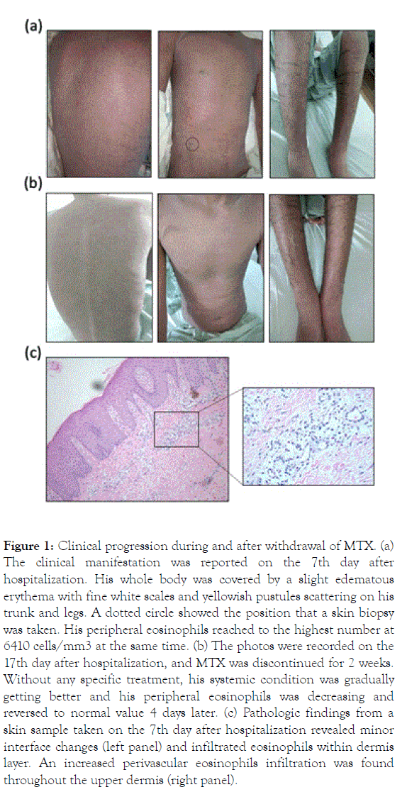 clinical-experimental-dermatology-research-clinical-manifestation