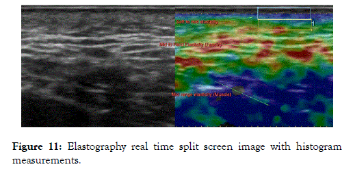 clinical-experimental-dermatology-research-elastography