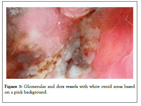 clinical-experimental-dermatology-research-glomerular