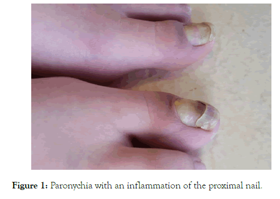 clinical-experimental-dermatology-research-inflammation