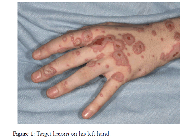 clinical-experimental-dermatology-research-lesions