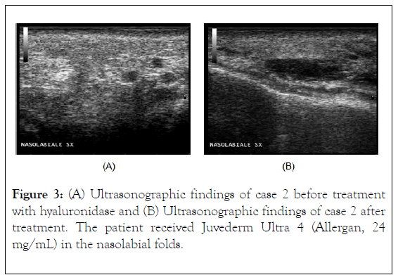 clinical-experimental-dermatology-research-patient