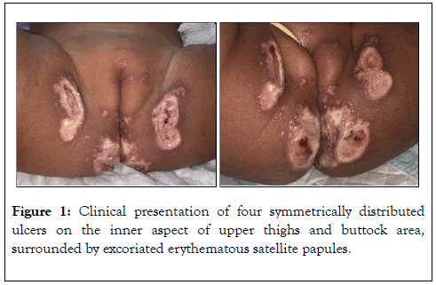 clinical-experimental-dermatology-research-presentation