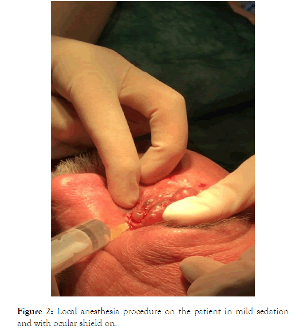 clinical-experimental-dermatology-research-procedure