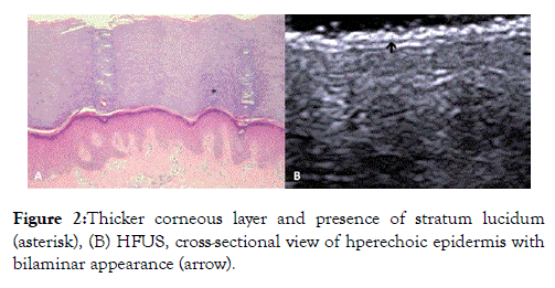 clinical-experimental-dermatology-research-stratum