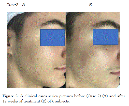 clinical-experimental-dermatology-research-treatment