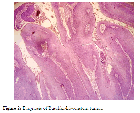 clinical-experimental-dermatology-research-tumor