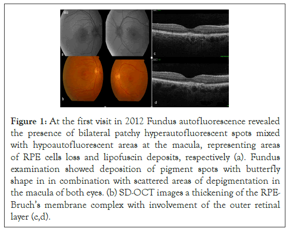 clinical-experimental-lipofuscin