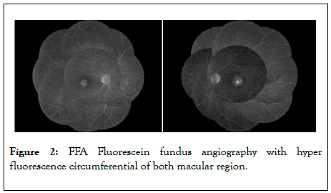 clinical-experimental-ophthalmology-Fluorescein