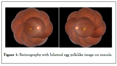 clinical-experimental-ophthalmology-Retinography