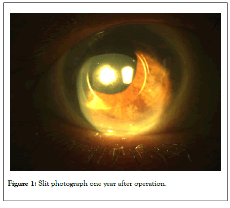 clinical-experimental-ophthalmology-Slit