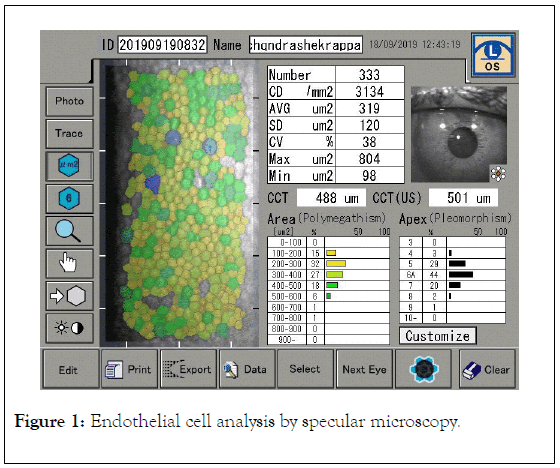 clinical-experimental-ophthalmology-analysis