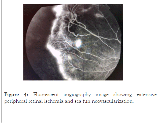 clinical-experimental-ophthalmology-angiography