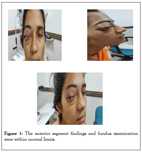 clinical-experimental-ophthalmology-anterior