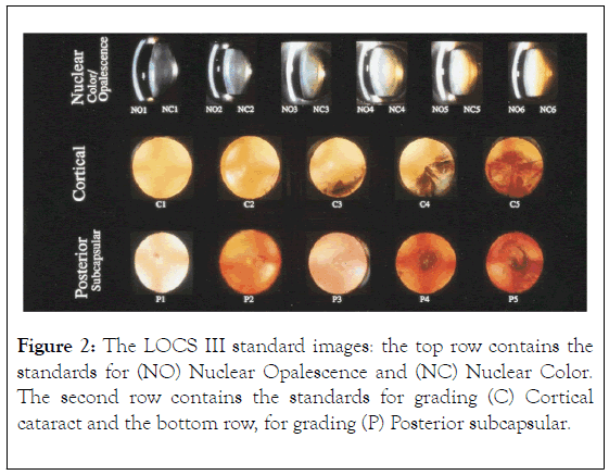 clinical-experimental-ophthalmology-contains