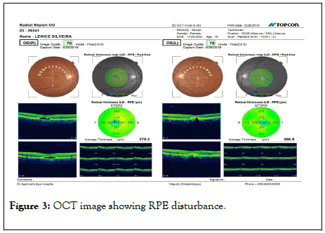 clinical-experimental-ophthalmology-disturbance