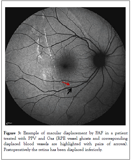 clinical-experimental-ophthalmology-macular