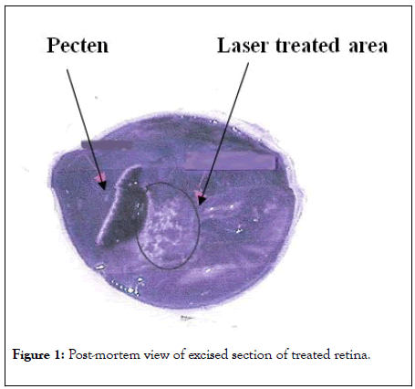 clinical-experimental-ophthalmology-mortem