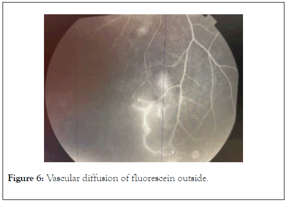 clinical-experimental-ophthalmology-outside