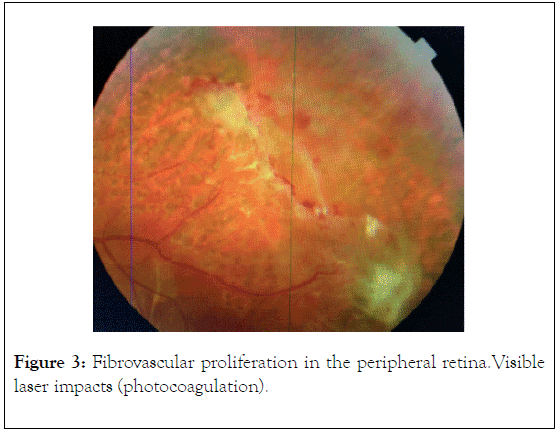 clinical-experimental-ophthalmology-peripheral