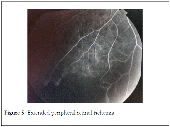 clinical-experimental-ophthalmology-retinal