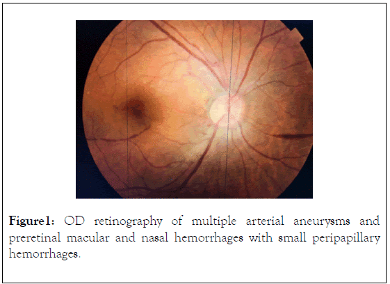 clinical-experimental-ophthalmology-retinography