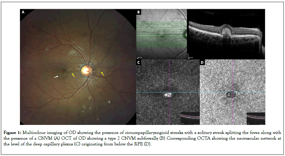 clinical-experimental-ophthalmology-subfoveally