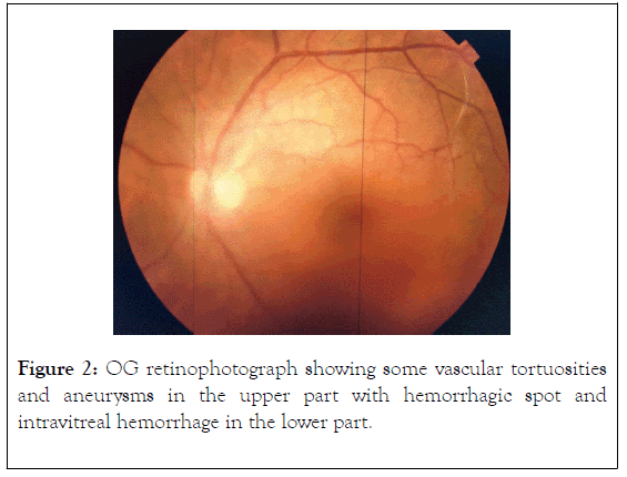 clinical-experimental-ophthalmology-vascular