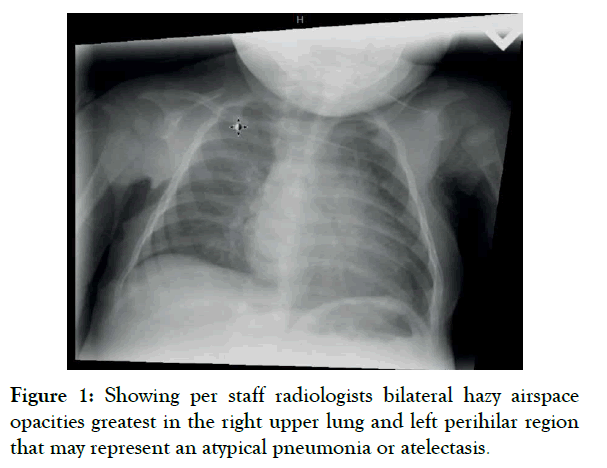 clinical-pediatrics-bilateral-hazy