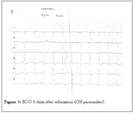 clinical-toxicology-pacemaker