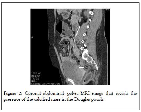 clinical-trials-Coronal