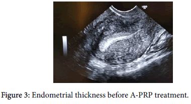 clinical-trials-Endometrial