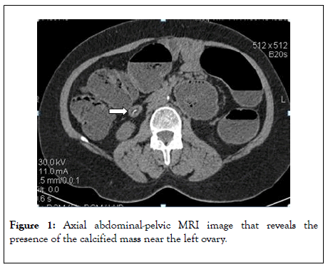 clinical-trials-abdominal