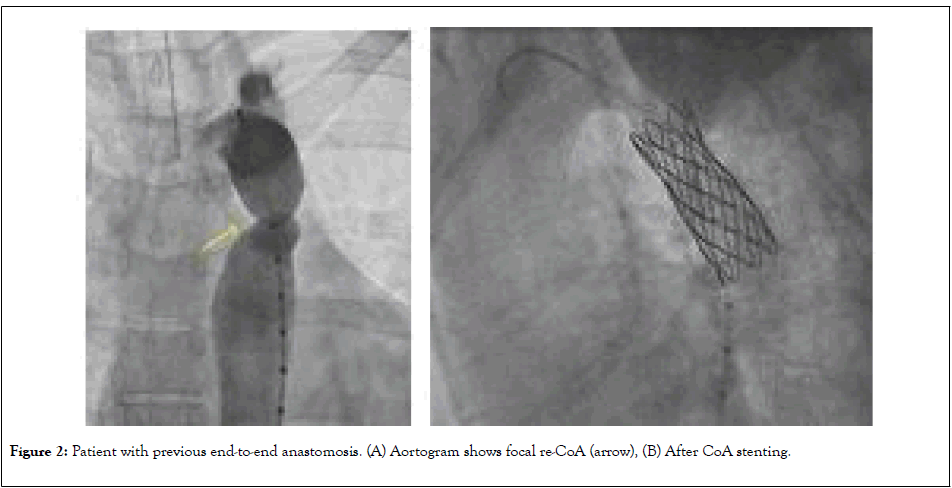 clinical-trials-anastomosis