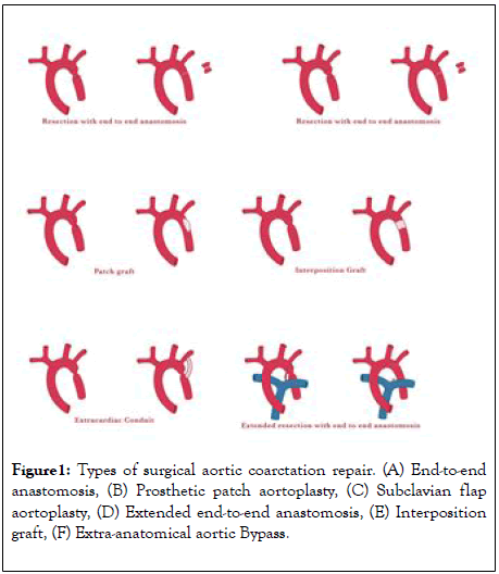 clinical-trials-aortic